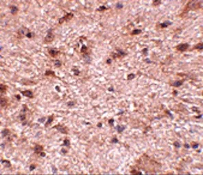 Anti-NIPSNAP3B antibody used in IHC (Paraffin sections) (IHC-P). GTX85354