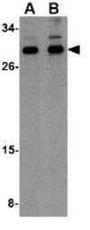 Anti-NIPSNAP3B antibody used in Western Blot (WB). GTX85354