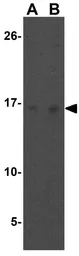 Anti-PIG-Y antibody used in Western Blot (WB). GTX85355