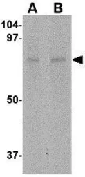 Anti-ZBTB1 antibody used in Western Blot (WB). GTX85357