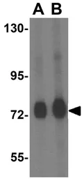 Anti-TOM70 antibody used in Western Blot (WB). GTX85358