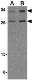 Anti-NIPSNAP3A antibody used in Western Blot (WB). GTX85359