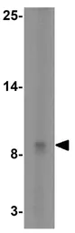 Anti-PIG-Y antibody used in Western Blot (WB). GTX85360