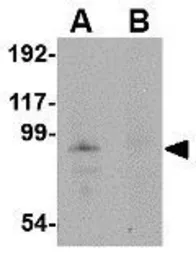 Anti-JPH4 antibody used in Western Blot (WB). GTX85362