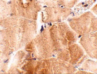 Anti-JPH2 antibody used in IHC (Paraffin sections) (IHC-P). GTX85364