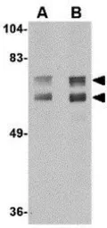 Anti-JPH2 antibody used in Western Blot (WB). GTX85364