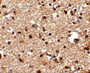 Anti-JPH4 antibody used in IHC (Paraffin sections) (IHC-P). GTX85365