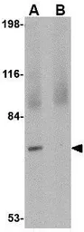 Anti-JPH4 antibody used in Western Blot (WB). GTX85365