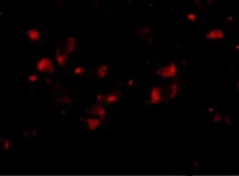 Anti-JPH4 antibody used in IHC (Paraffin sections) (IHC-P). GTX85365