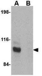 Anti-JPH3 antibody used in Western Blot (WB). GTX85366