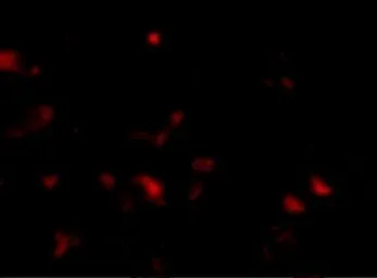 Anti-JPH3 antibody used in IHC (Paraffin sections) (IHC-P). GTX85366