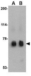 Anti-MEX3C antibody used in Western Blot (WB). GTX85374
