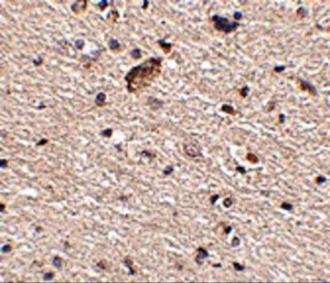 Anti-Spred1 antibody used in IHC (Paraffin sections) (IHC-P). GTX85376