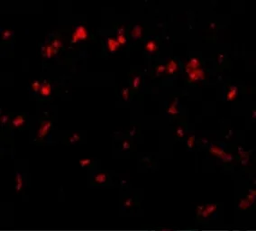 Anti-Spred1 antibody used in IHC (Paraffin sections) (IHC-P). GTX85376