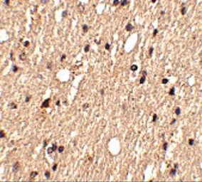 Anti-Spred1 antibody used in IHC (Paraffin sections) (IHC-P). GTX85377