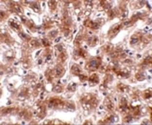 Anti-CUEDC1 antibody used in IHC (Paraffin sections) (IHC-P). GTX85378