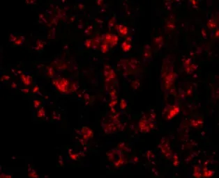 Anti-CUEDC1 antibody used in IHC (Paraffin sections) (IHC-P). GTX85378