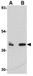 Anti-CUEDC1 antibody used in Western Blot (WB). GTX85378