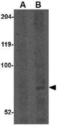 Anti-CNOT4 antibody used in Western Blot (WB). GTX85379