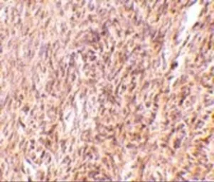 Anti-TRIM30 antibody used in IHC (Paraffin sections) (IHC-P). GTX85385