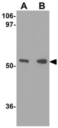 Anti-TRIM30 antibody used in Western Blot (WB). GTX85385