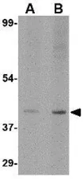 Anti-Slc35D1 antibody used in Western Blot (WB). GTX85390