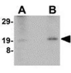 Anti-Nanos2 antibody used in Western Blot (WB). GTX85392
