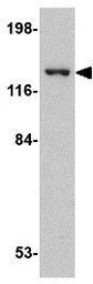 Anti-SAPAP4 antibody used in Western Blot (WB). GTX85394