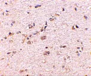 Anti-DLGAP1 antibody used in IHC (Paraffin sections) (IHC-P). GTX85396