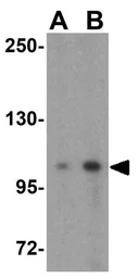 Anti-DLGAP1 antibody used in Western Blot (WB). GTX85396