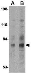 Anti-Syntaphilin antibody used in Western Blot (WB). GTX85397