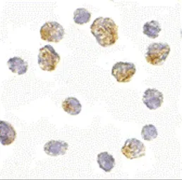Anti-Slc35D1 antibody used in Immunocytochemistry/ Immunofluorescence (ICC/IF). GTX85399
