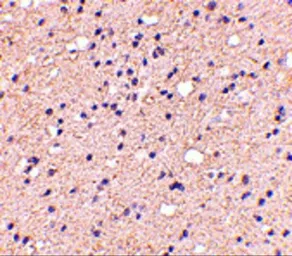 Anti-ELOVL6 antibody used in IHC (Paraffin sections) (IHC-P). GTX85403