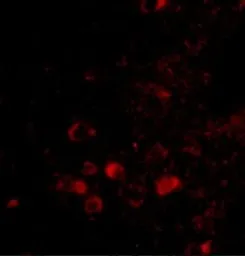 Anti-ELOVL6 antibody used in IHC (Paraffin sections) (IHC-P). GTX85403