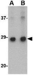Anti-ELOVL6 antibody used in Western Blot (WB). GTX85403