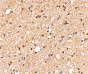 Anti-LGI2 antibody used in IHC (Paraffin sections) (IHC-P). GTX85408