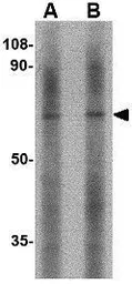 Anti-LGI2 antibody used in Western Blot (WB). GTX85408