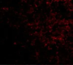 Anti-LGI2 antibody used in IHC (Paraffin sections) (IHC-P). GTX85408