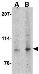 Anti-Slitrk4 antibody used in Western Blot (WB). GTX85410