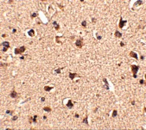 Anti-SLITRK6 antibody used in IHC (Paraffin sections) (IHC-P). GTX85411