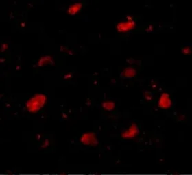 Anti-Slitrk5 antibody used in IHC (Paraffin sections) (IHC-P). GTX85414