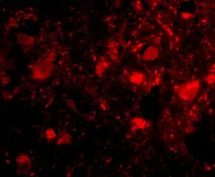 Anti-Slitrk3 antibody used in IHC (Paraffin sections) (IHC-P). GTX85417