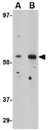 Anti-Plxdc2 antibody used in Western Blot (WB). GTX85420