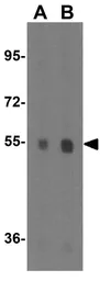 Anti-Plxdc2 antibody used in Western Blot (WB). GTX85420