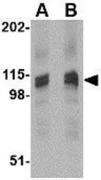 Anti-SAPAP3 antibody used in Western Blot (WB). GTX85421