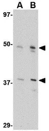 Anti-FEZ2 antibody used in Western Blot (WB). GTX85422