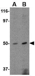 Anti-FEZ2 antibody used in Western Blot (WB). GTX85423