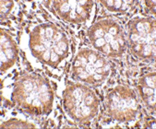 Anti-TEM1 antibody used in IHC (Paraffin sections) (IHC-P). GTX85429