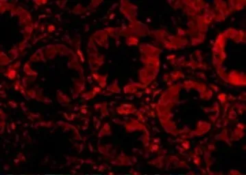 Anti-TEM1 antibody used in IHC (Paraffin sections) (IHC-P). GTX85429