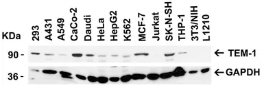 Anti-TEM1 antibody used in Western Blot (WB). GTX85429